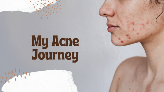 10 Best Acne-Fighting Products (2025 Dermatologist-Approved)