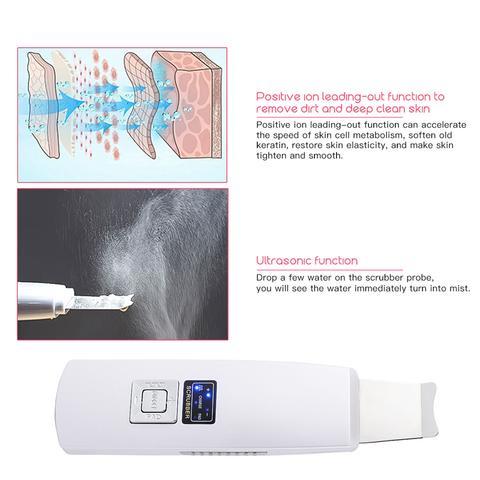 Limpiador ultrasónico de piel LuxuryGlow: limpiador facial profundo y eliminador de puntos negros