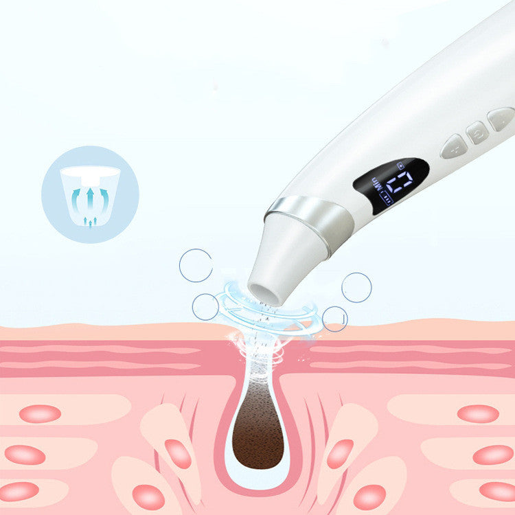 LuxuryGlow Smart Visual Blackhead Remover with Mobile App & HD Pore View