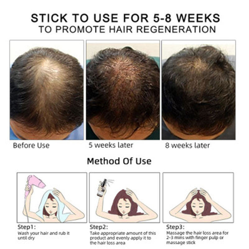 Aceite para el Crecimiento del Cabello GZBITYHN: Aceite Esencial Nutritivo para el Cuero Cabelludo y el Crecimiento del Cabello