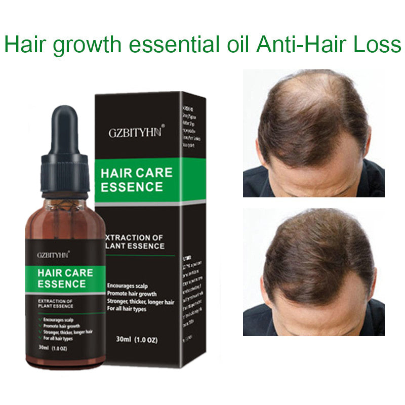 Aceite para el Crecimiento del Cabello GZBITYHN: Aceite Esencial Nutritivo para el Cuero Cabelludo y el Crecimiento del Cabello