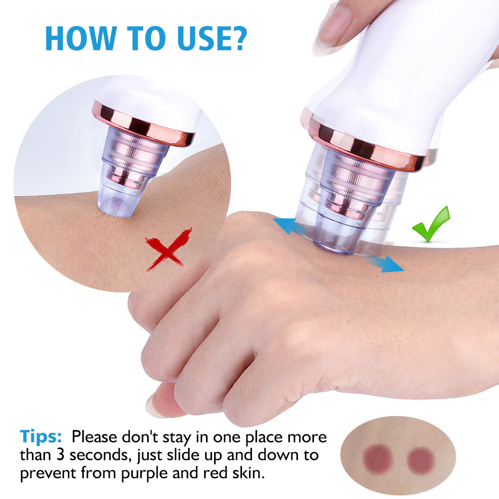 LuxuryGlow Electric Blackhead Remover – Deep Pore Cleaner with 5 Suction Levels