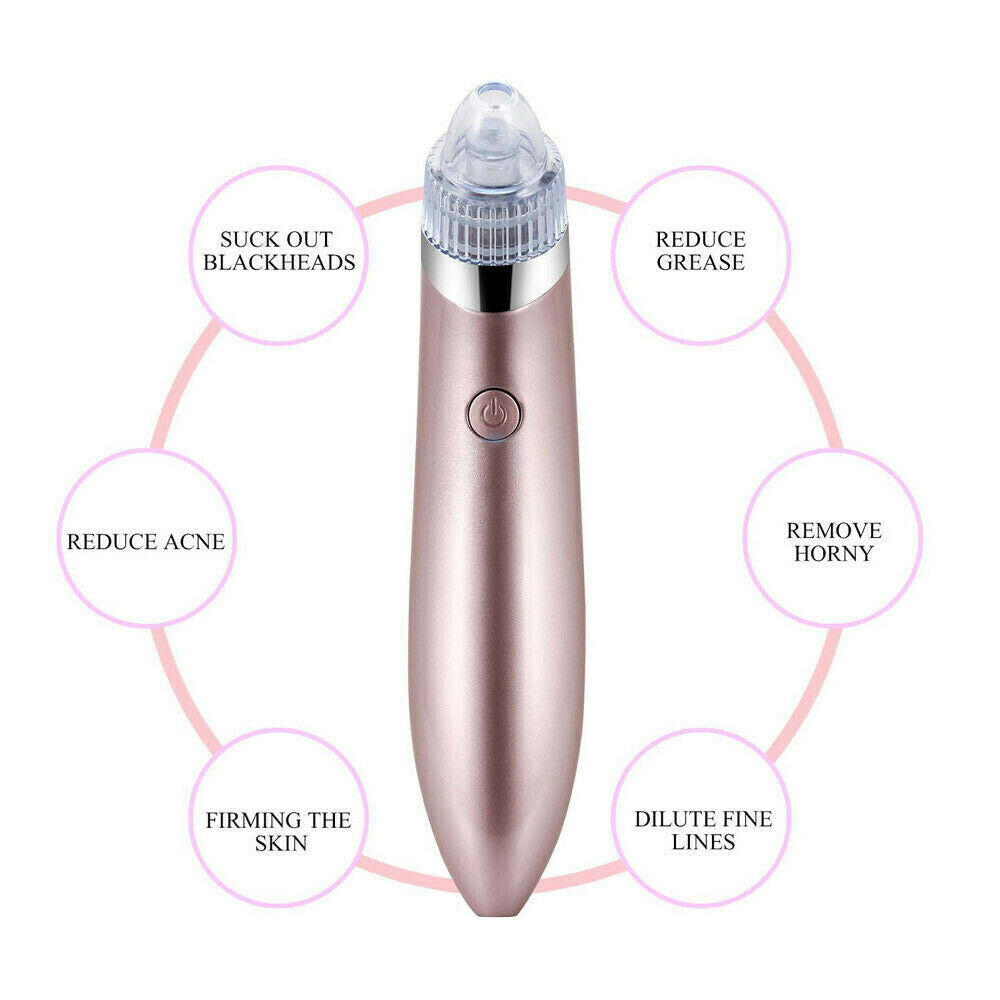 Aspiradora eléctrica LuxuryGlow para eliminar puntos negros (4 cabezales, USB)