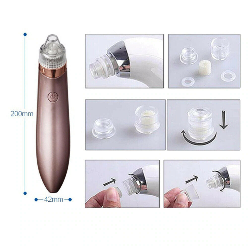 Aspiradora eléctrica LuxuryGlow para eliminar puntos negros (4 cabezales, USB)