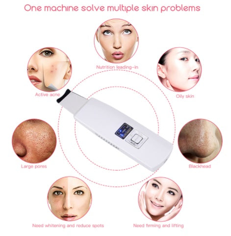 Limpiador ultrasónico de piel LuxuryGlow: limpiador facial profundo y eliminador de puntos negros