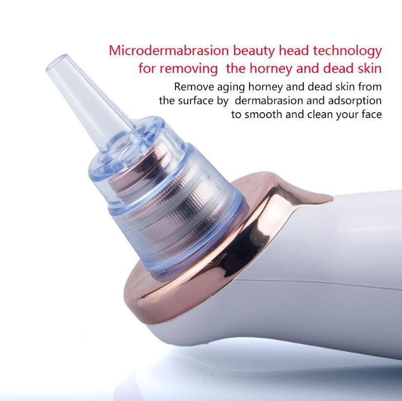 LuxuryGlow Electric Blackhead Remover – Deep Pore Cleaner with 5 Suction Levels