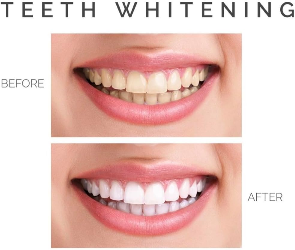 Tiras blanqueadoras naturales para dientes: tratamiento de 21 días, 42 tiras, seguro para el esmalte y sin sensibilidad.