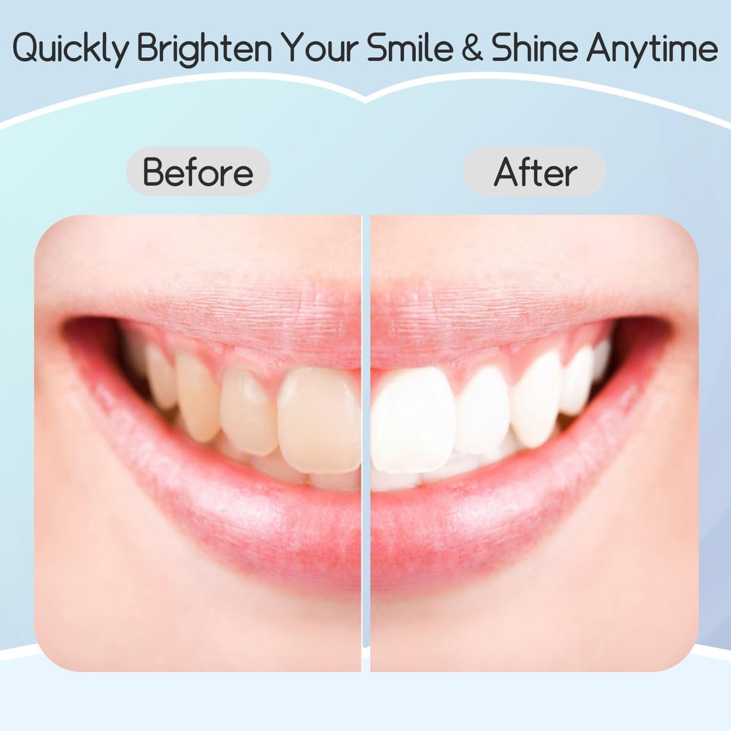 Shodu Professional Teeth Whitening Strips – Enamel-Safe, Sensitive-Friendly, Deep Stain Removal (7 Treatments, 14 Strips)
