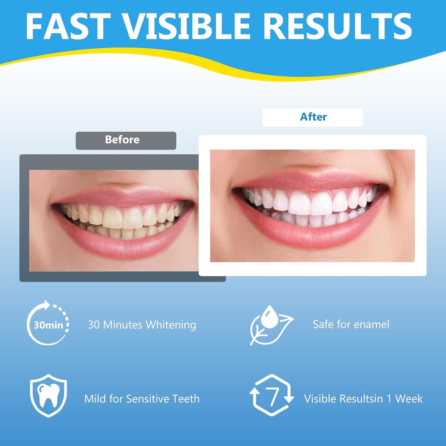 Tiras blanqueadoras Milumber para dientes sensibles – 42 tiras de menta