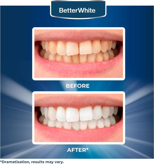 BetterWhite Professional Teeth Whitening Strips – 28 Strips (7 Treatments), Peroxide-Free, Enamel-Safe, Gentle Formula for Sensitive Teeth