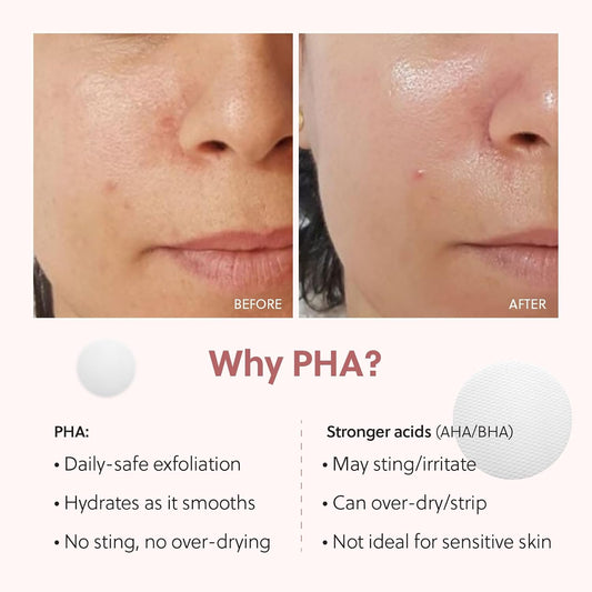 QUIA Dual-Action Toner Pads – Exfoliate & Hydrate in One Step – Gentle PHA Formula for Sensitive Skin – 70 Textured Pads