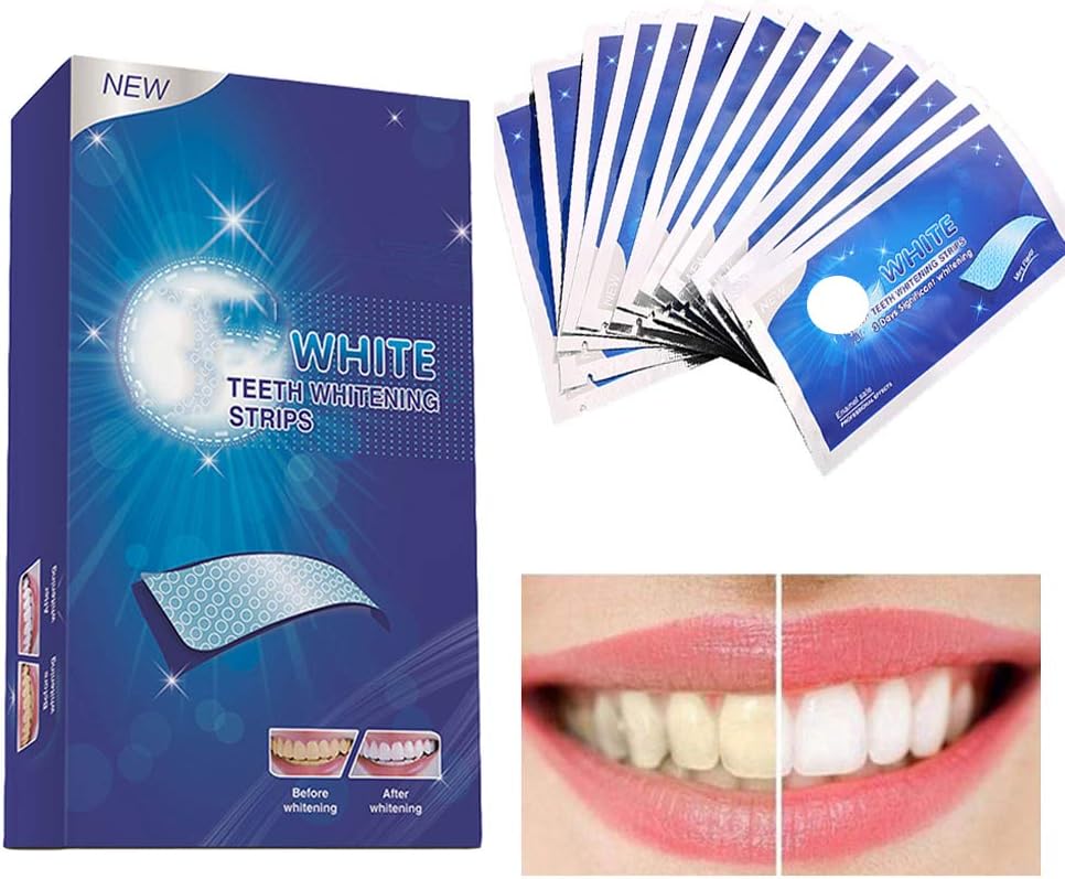 Ceonam Teeth Whitening Strips – 28 Paraben-Free Strips (14 Pack), Enamel-Safe, Sensitivity-Free, Removes Deep Stains from Coffee, Tea & Smoking