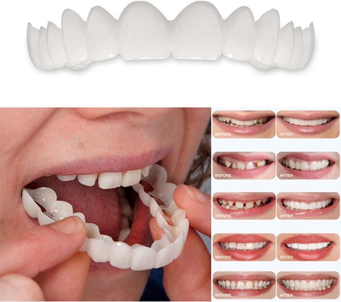 Snap-On Veneers Teeth Kit for Women & Men | Natural Tooth Replacement, Comfortable Cosmetic Dentures