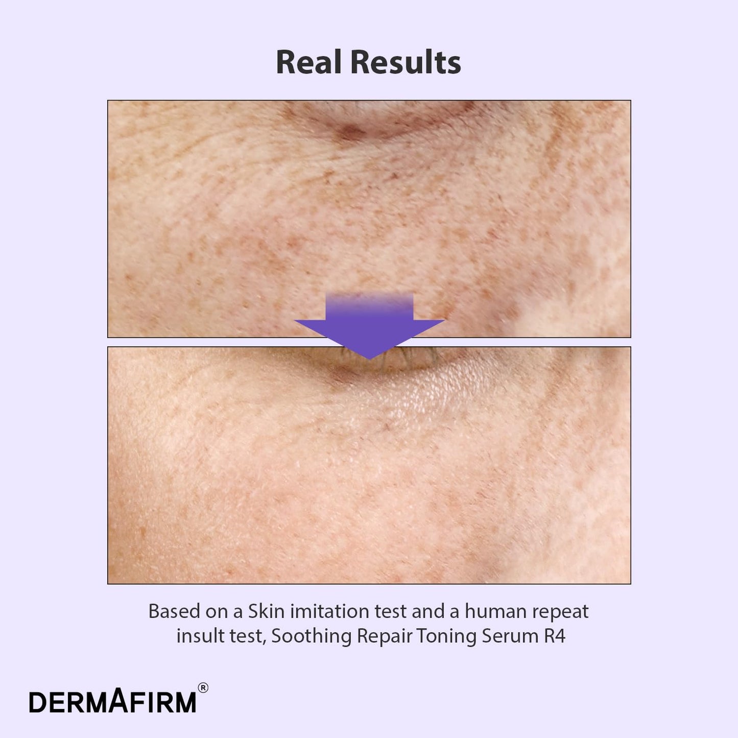 DERMAFIRM Bakuchiol Retinol Serum R4 with Niacinamide & Peptides – Anti-Aging, Soothing & Repairing Korean Face Serum for Glass Skin (30ml)