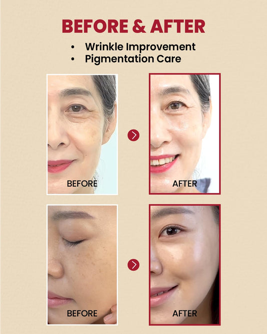 KSECRET SEOUL 1988 Retinal Serum with Black Ginseng & Peptides – Anti-Wrinkle, Dark Spot Corrector, Korean Skincare 30ml