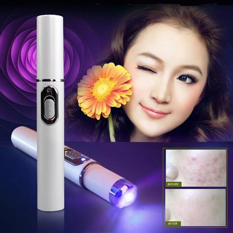 قلم ليزر الضوء الأزرق لعلاج حب الشباب من LuxuryGlow - جهاز علاج البشرة لإزالة التجاعيد والندبات