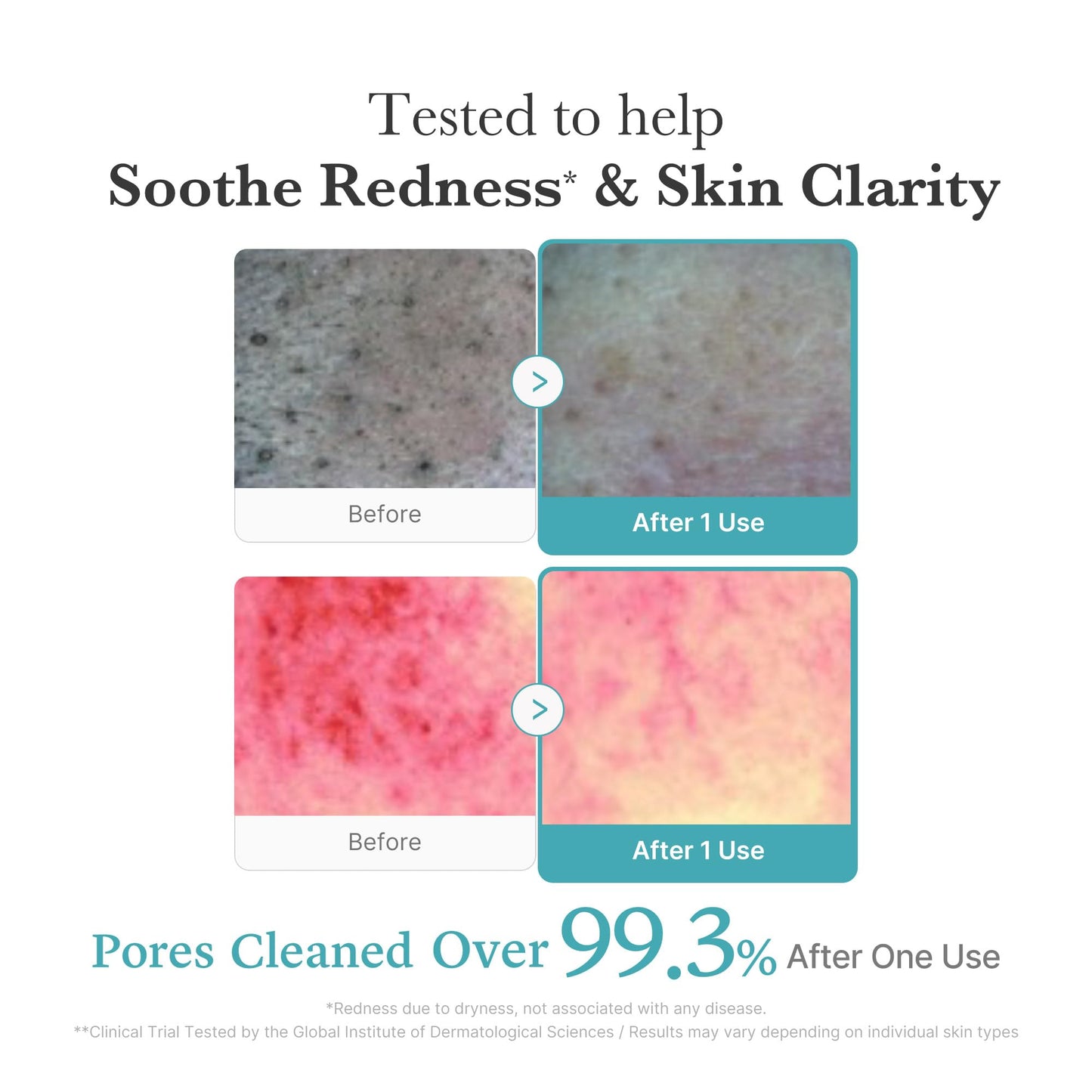 Medicube PDRN Marshmallow Whip Cleanser – Korean Hydrating Foam Face Wash with Niacinamide & Hyaluronic Acid for Pore Care, Uneven Skin Tone & Radiant Glow (143g)