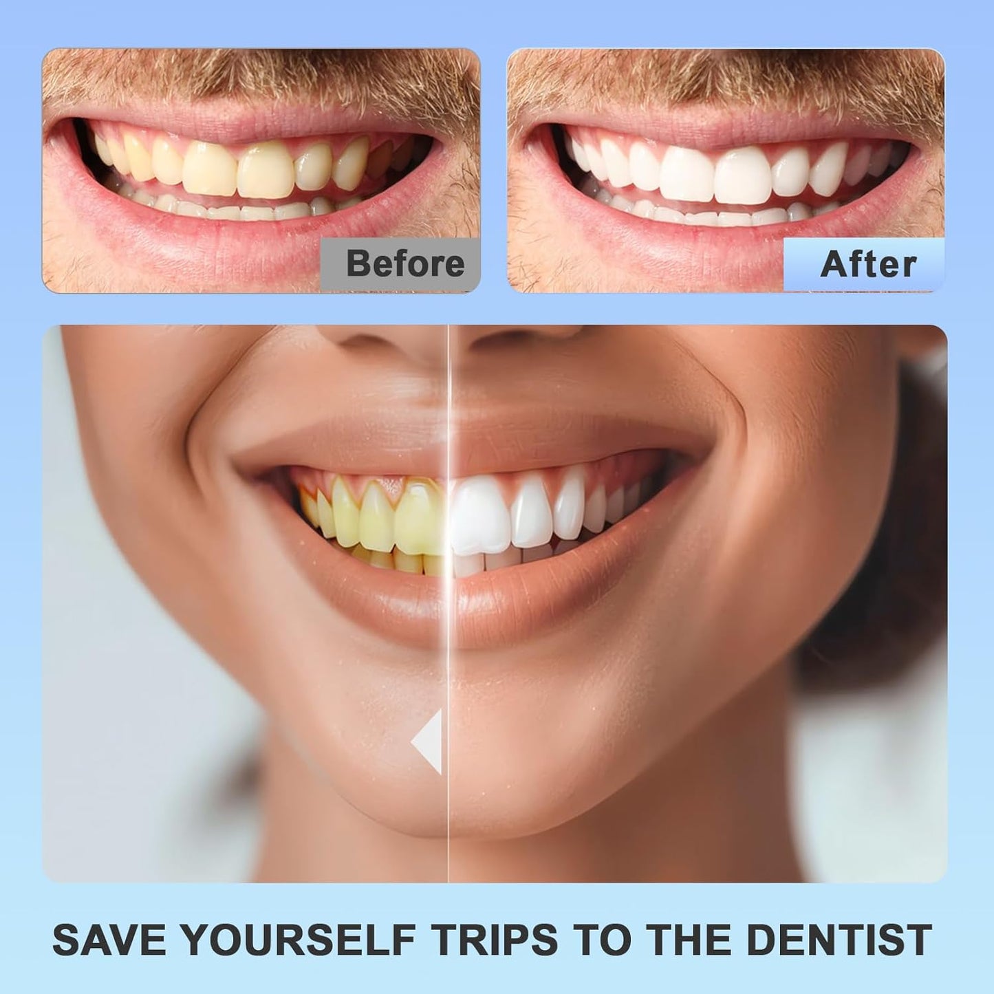 Teeth Whitening Strips Kit – 14 Treatments for Bright Smile, Stain Removal & Sensitive Teeth Care (28 Pcs)