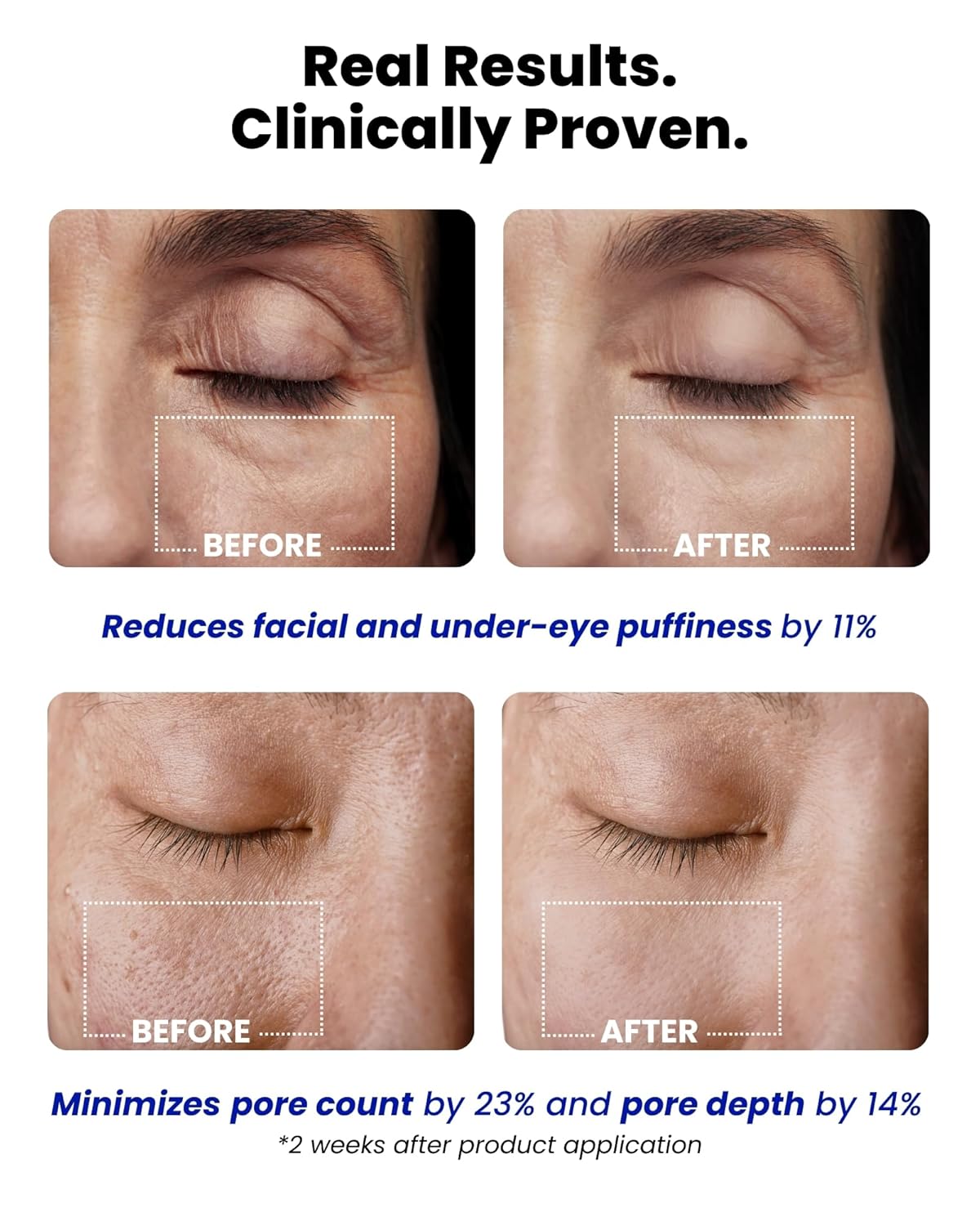 VAROL Ice Roll Serum – Cooling Roll-On for Puffy Eyes, Pore Minimizing & Hydrating Korean Skincare
