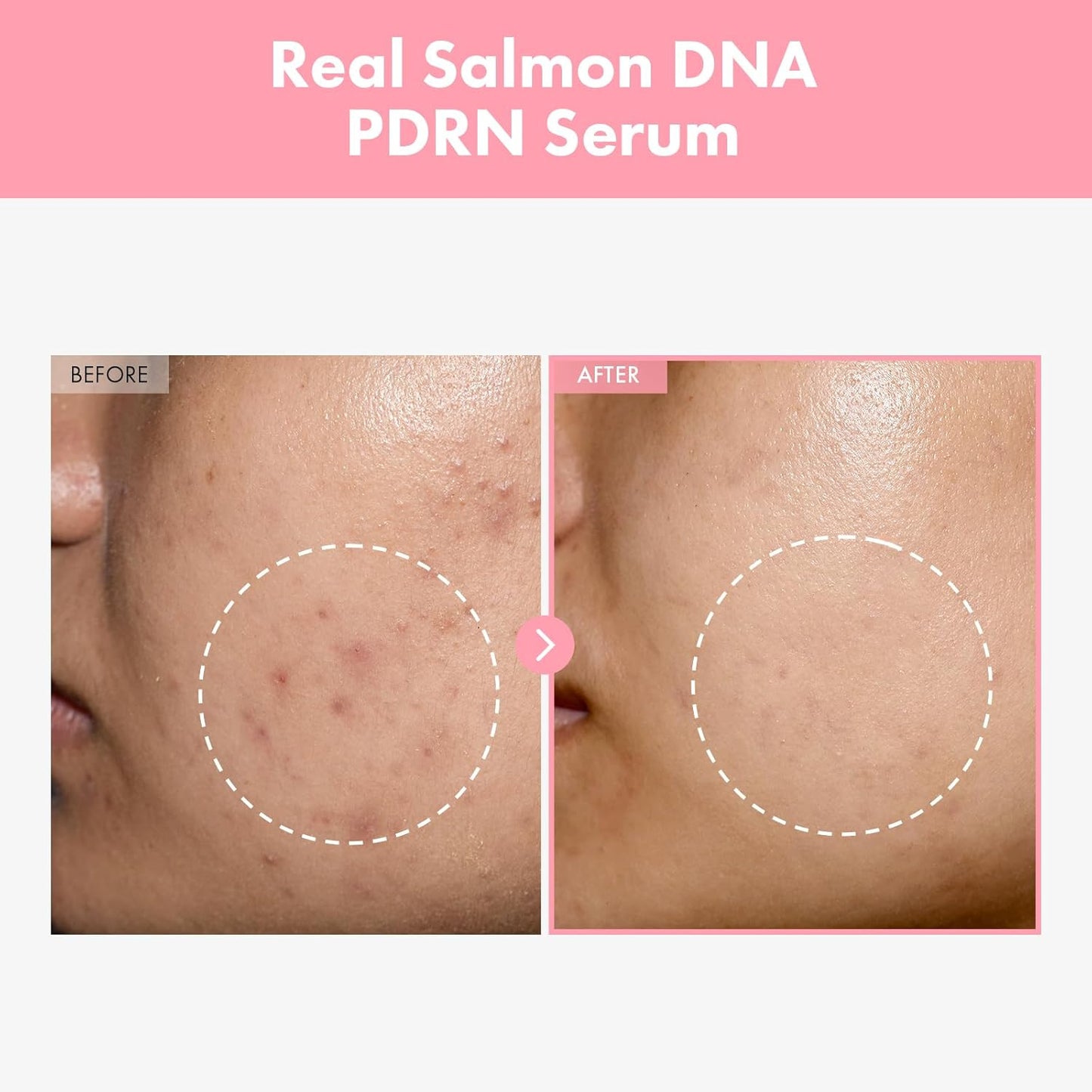 Pink Peptide 12 PDRN Serum with Salmon DNA, 12 Peptides & Niacinamide – Hydrating, Firming & Brightening Korean Skincare (33ml / 1.11 fl.oz.)