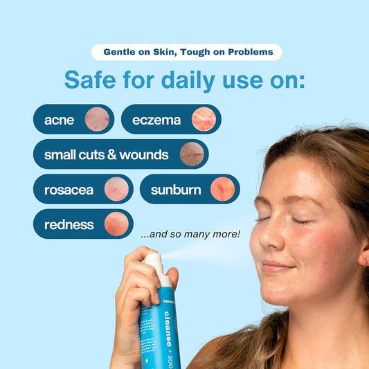 Hypochlorous Acid Spray 6.8 oz – HOCl Face & Skin Mist for Acne, Eczema, Redness & Irritation Relief – Multi-Purpose Cleanser & Soothing Spray