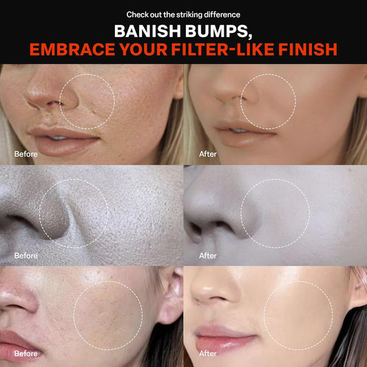 PURCELL 24/7 Colostrum Ampoule Mist – Glass Skin Glow, Long-Lasting Hydration & Poreless Smooth Finish – Hyaluronic Acid & Vitamins – 1.85 fl oz