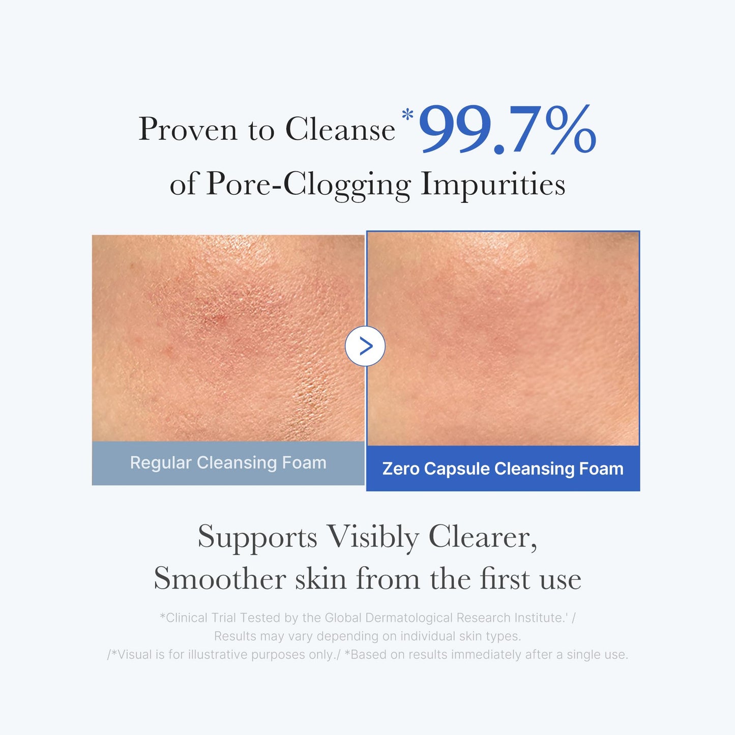 Medicube PDRN Marshmallow Whip Cleanser – Korean Hydrating Foam Face Wash with Niacinamide & Hyaluronic Acid for Pore Care, Uneven Skin Tone & Radiant Glow (143g)