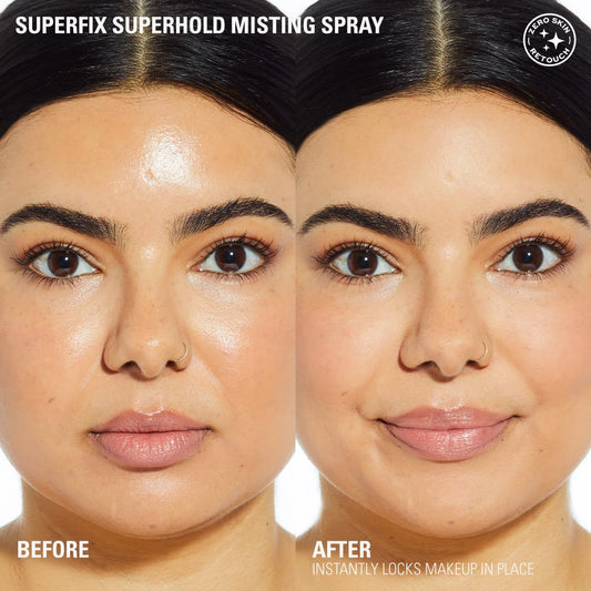 Revolution Superfix Makeup Setting Spray – Ultra-Matte, Long-Lasting Mist with Aloe & Vitamin E – Shine-Free, Vegan, Lightweight Fixer 5.07 fl oz