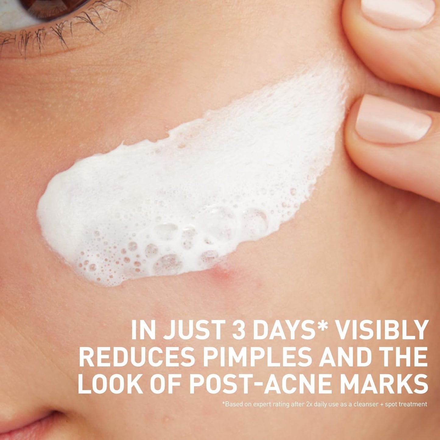 Limpiador facial para el acné CeraVe Clay-To-Foam con ácido salicílico y arcilla de caolín – 113 ml