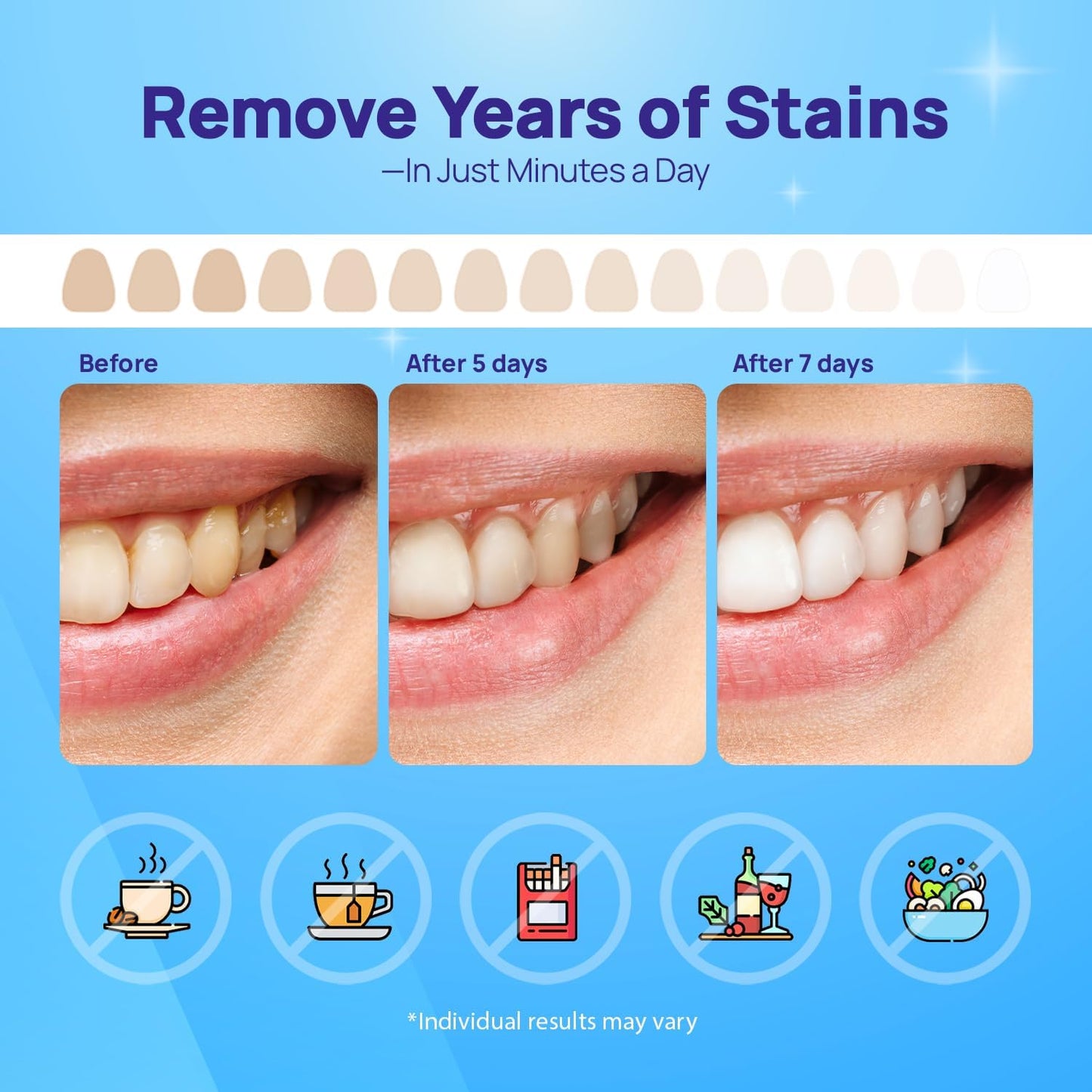Whitebite Pro Teeth Whitening Strips – 7-Day Enamel-Safe Stain Removal Kit with Non-Slip Design