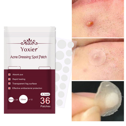 LuxuryGlow Invisible Acne Spot Patches – Blemish Treatment Stickers for Clear Skin
