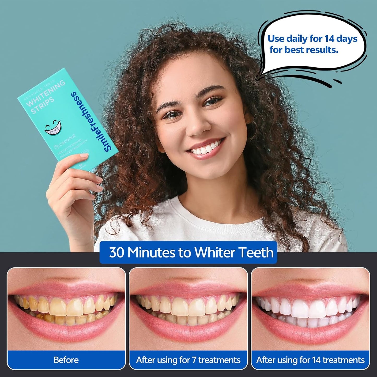 SmileFreshness Teeth Whitening Strips Kit (14 Treatments, 28 Strips) – Clinically Proven, Enamel-Safe, Reduced Sensitivity, Coconut-Infused Whitening