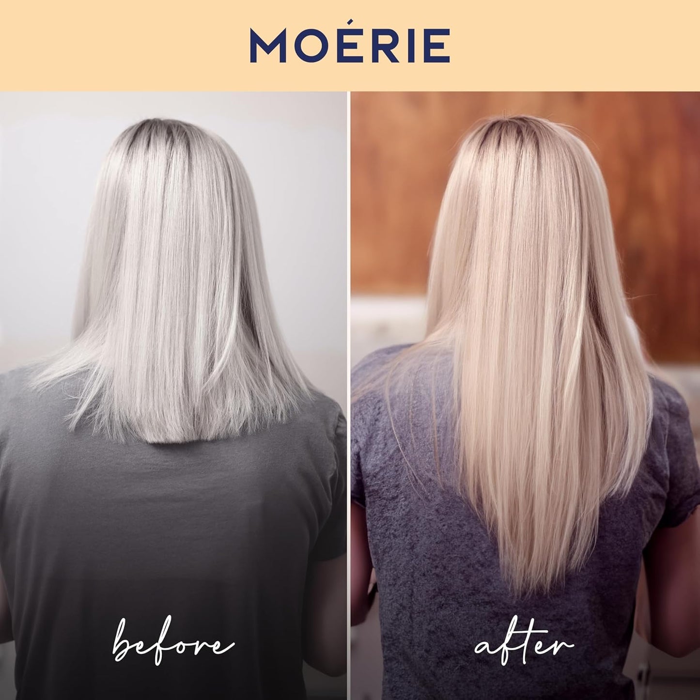 Moerie Volumizing Shampoo & Conditioner Set – Natural Hair Thickening for Hair Loss with 100+ Active Nutrients – Sulfate-Free, 2 x 8.45 fl oz