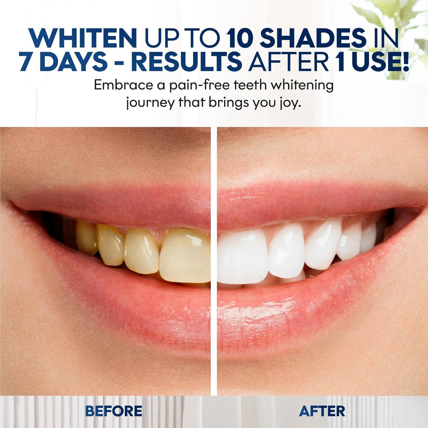 Chloe’C Teeth Whitening Strips – 7-Day Peroxide-Free Mint Whitening for Sensitive Teeth