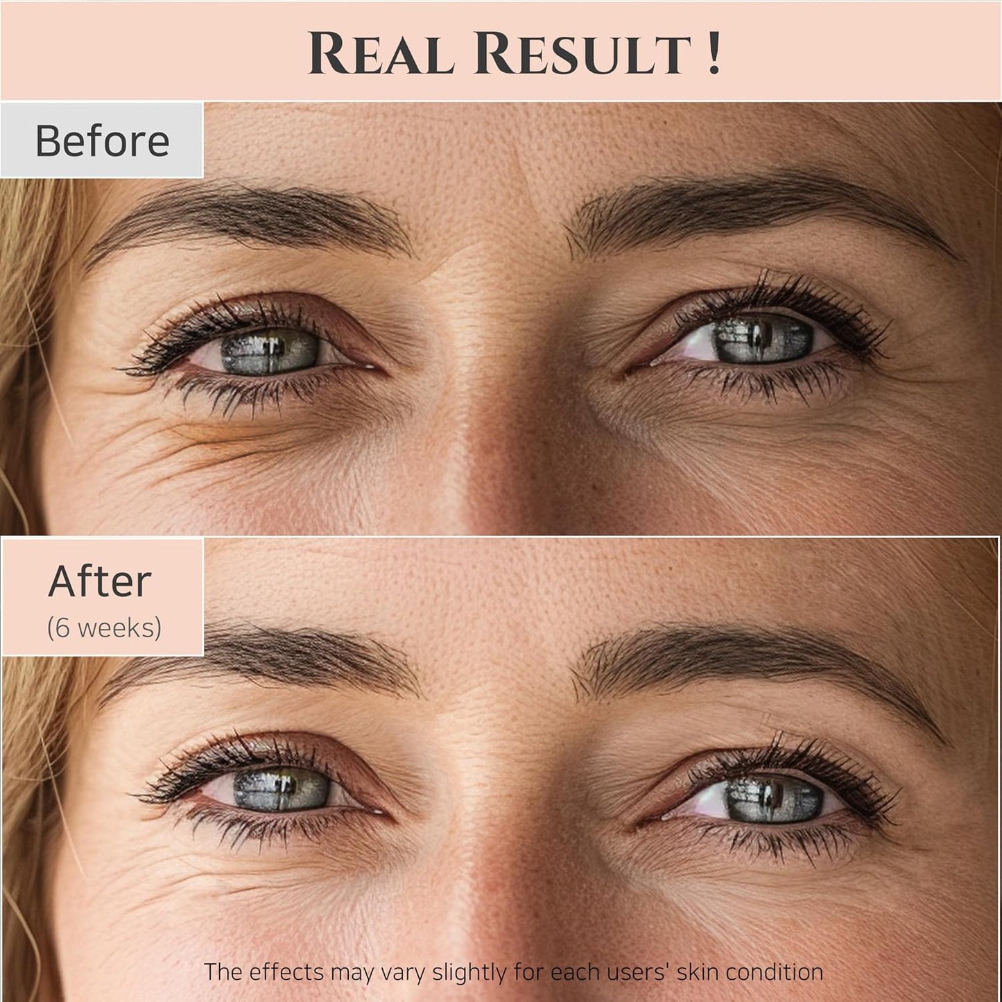 Beauty of Joseon Revive Eye Serum – Korean Retinal & Niacinamide Eye Cream for Wrinkles, Dark Circles & Hydration (30ml / 1 fl.oz × 2 Pack)