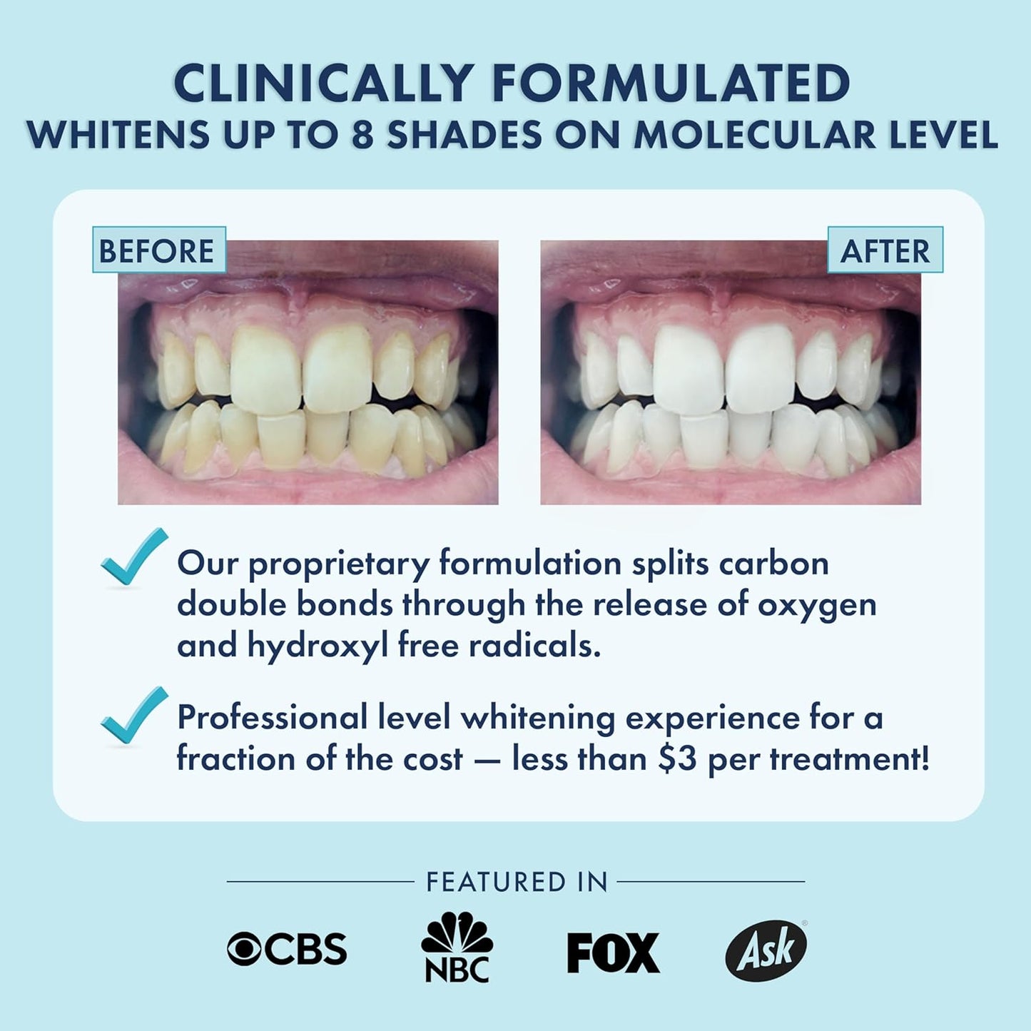 LIVFRESH Teeth Whitening Strips – 28 Strips (14 Treatments) | Enamel-Safe, Coconut Oil & Hydrogen Peroxide Formula, Gentle for Sensitive Teeth, Visible Results in 14 Days