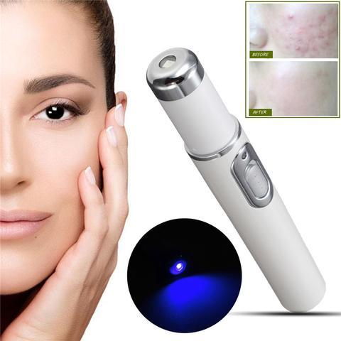 قلم ليزر الضوء الأزرق لعلاج حب الشباب من LuxuryGlow - جهاز علاج البشرة لإزالة التجاعيد والندبات