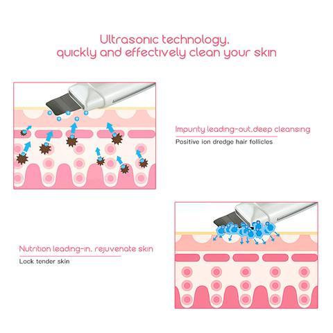 Limpiador ultrasónico de piel LuxuryGlow: limpiador facial profundo y eliminador de puntos negros