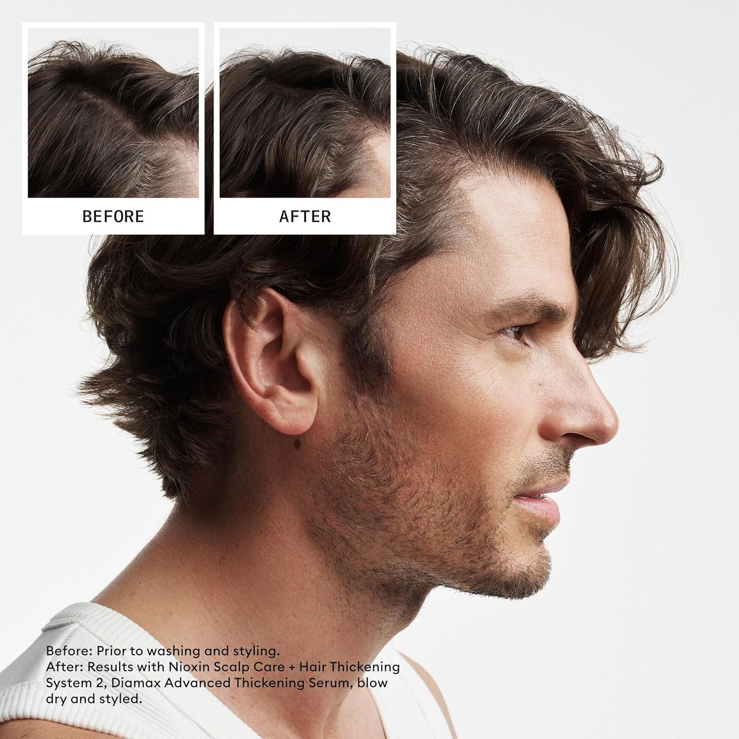 Nioxin Shampoo & Conditioner Liter Duo Set with Pumps – Strengthen & Boost Hair Density for Thinning Hair (Systems 1-4)