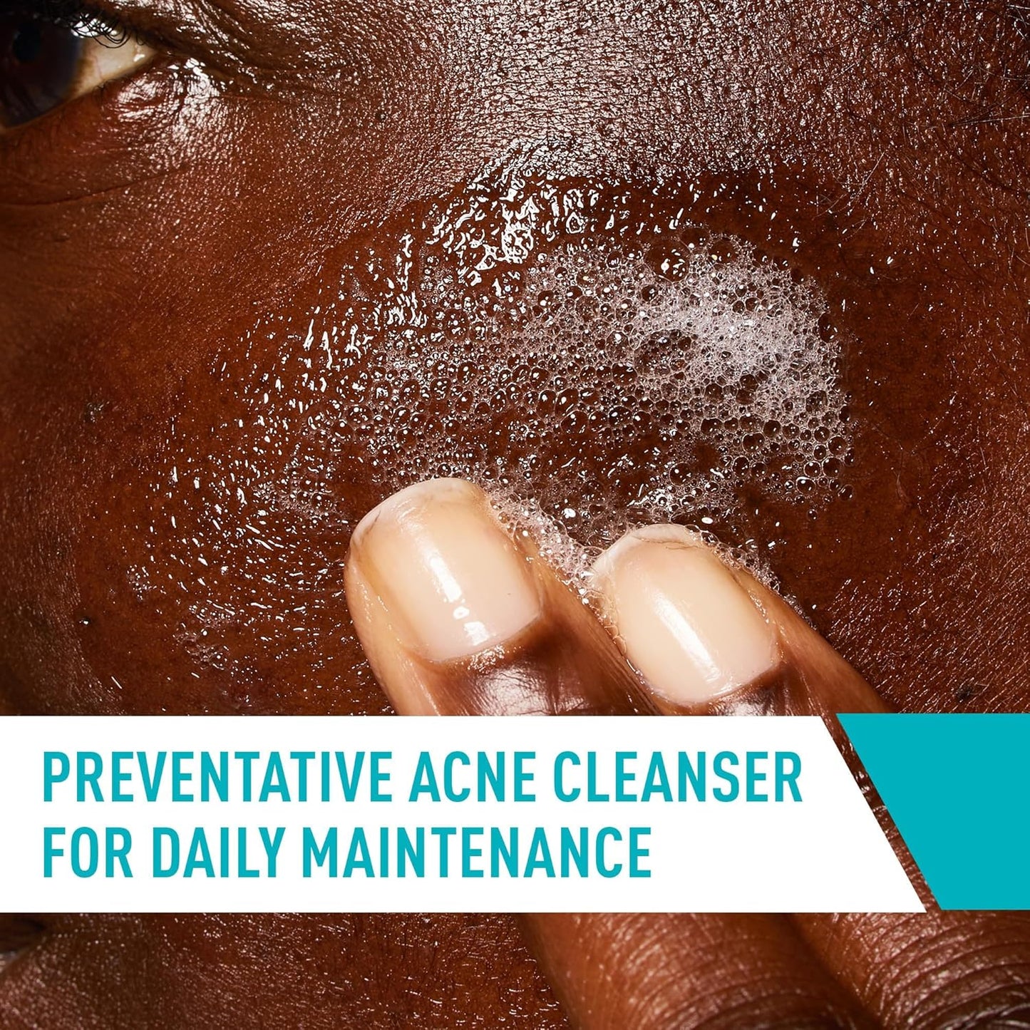 CeraVe Acne Control Face Wash with Salicylic Acid, Clay & Niacinamide – 8oz