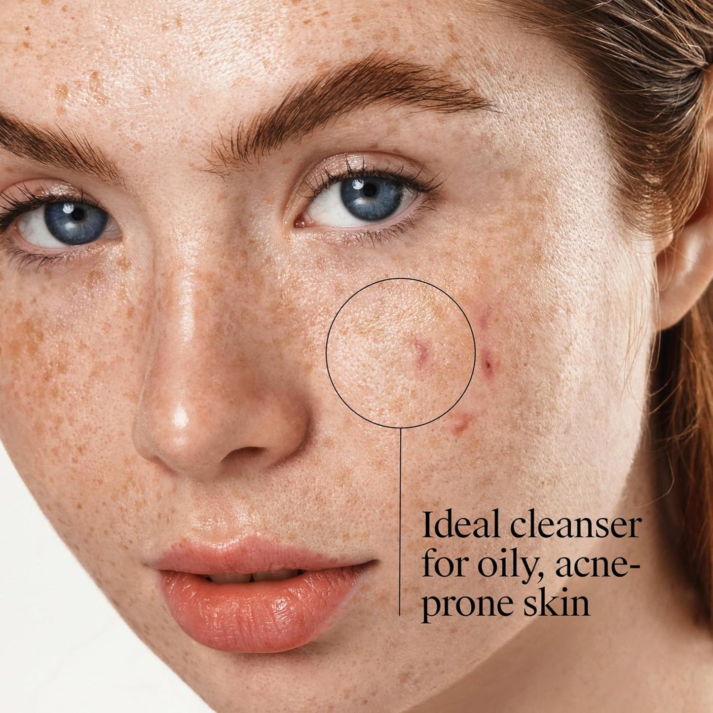 Neutrogena Oil-Free Pink Grapefruit Acne Face Wash | Vitamin C + 2% Salicylic Acid | Daily Blemish & Blackhead Cleanser | 9.1 fl oz