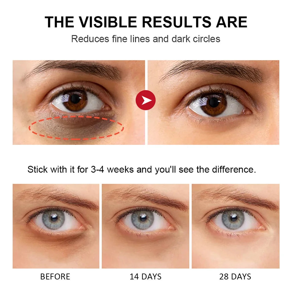 Crema de ojos con retinol en barra ibcccndc: suero iluminador y antiedad para ojeras (3 g)