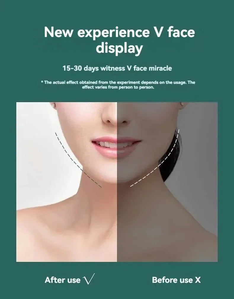 LuxuryGlow Slimming Face Belt — Double Chin Reducer & V Face Lifting Mask for All Face Shapes