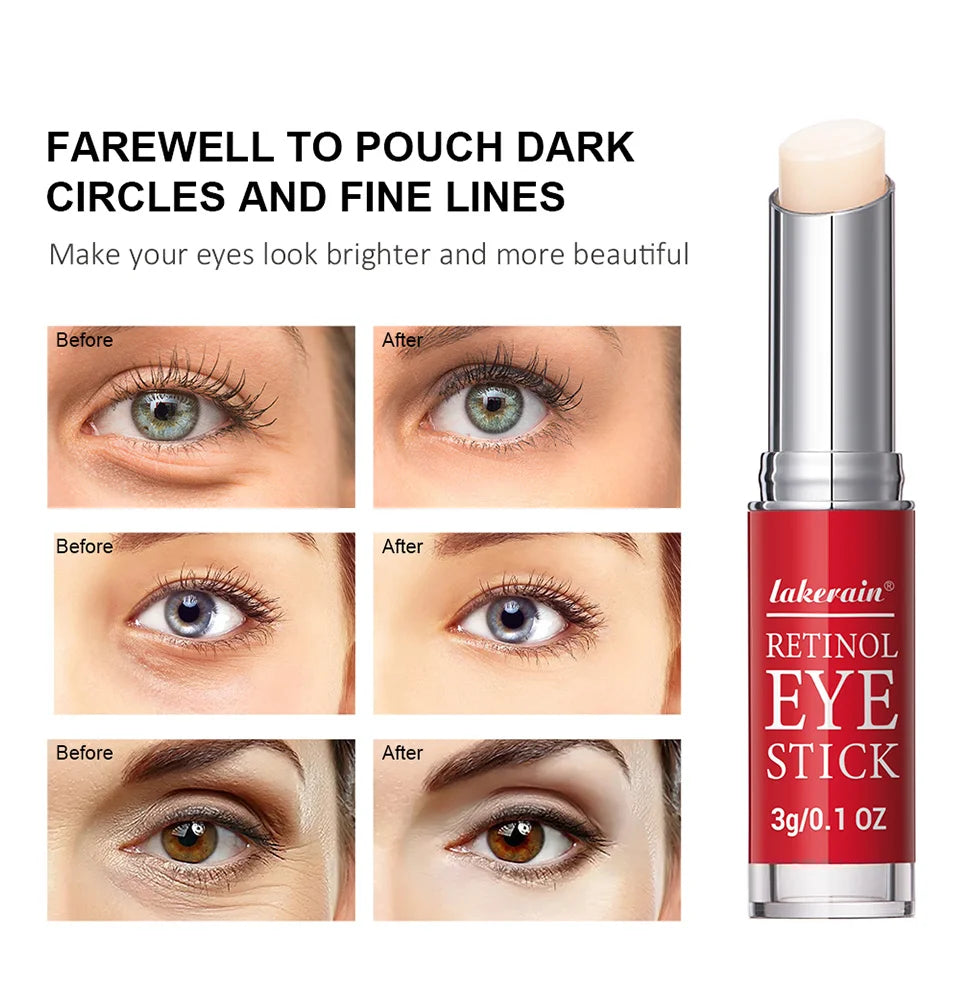 Crema de ojos con retinol en barra ibcccndc: suero iluminador y antiedad para ojeras (3 g)