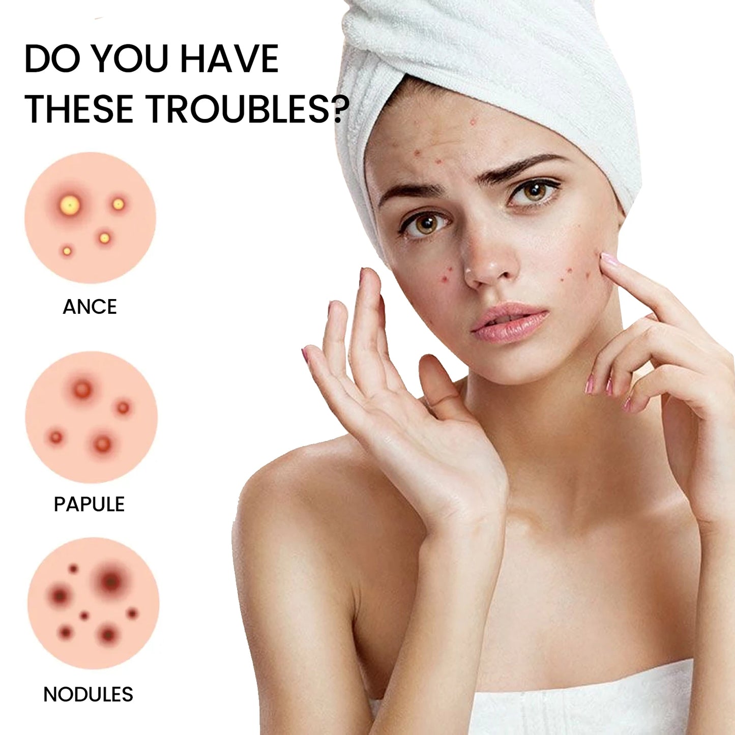 Jaysuing Acne Repair Patches – 200 Invisible Pimple Patches with Tea Tree & Witch Hazel for Fast Acne Healing & Blemish Removal