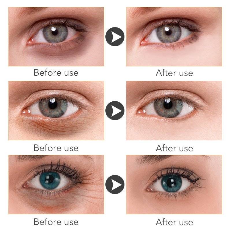 AnYi Beauty 30ml Anti-Aging Eye Cream – Hydrating & Firming Formula for Bright Eyes