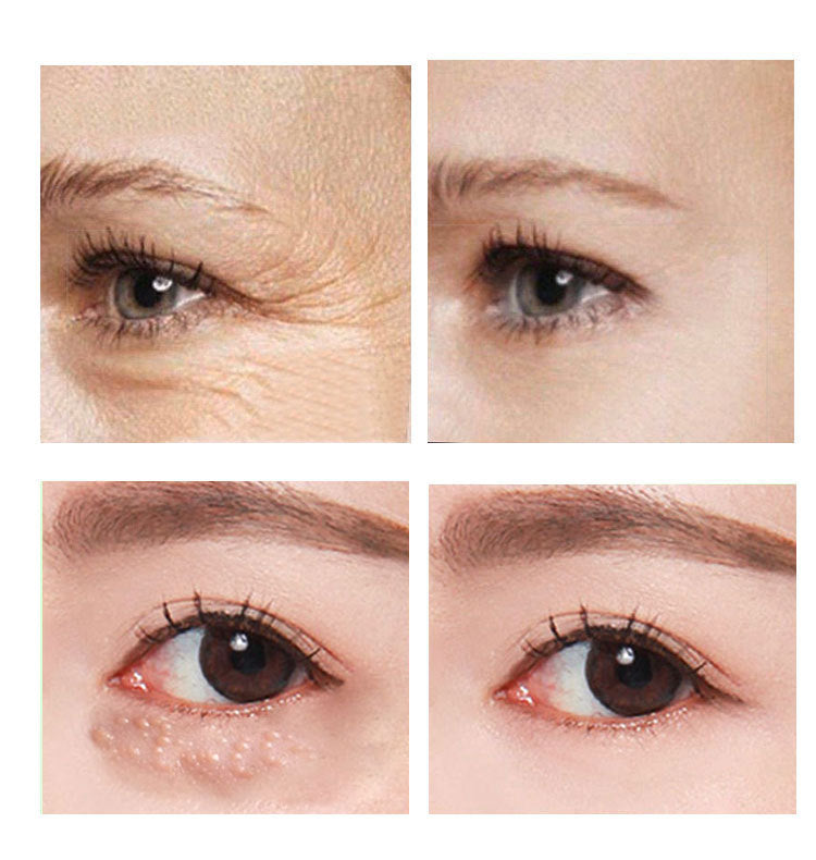 AnYi Beauty 30ml Anti-Aging Eye Cream – Hydrating & Firming Formula for Bright Eyes