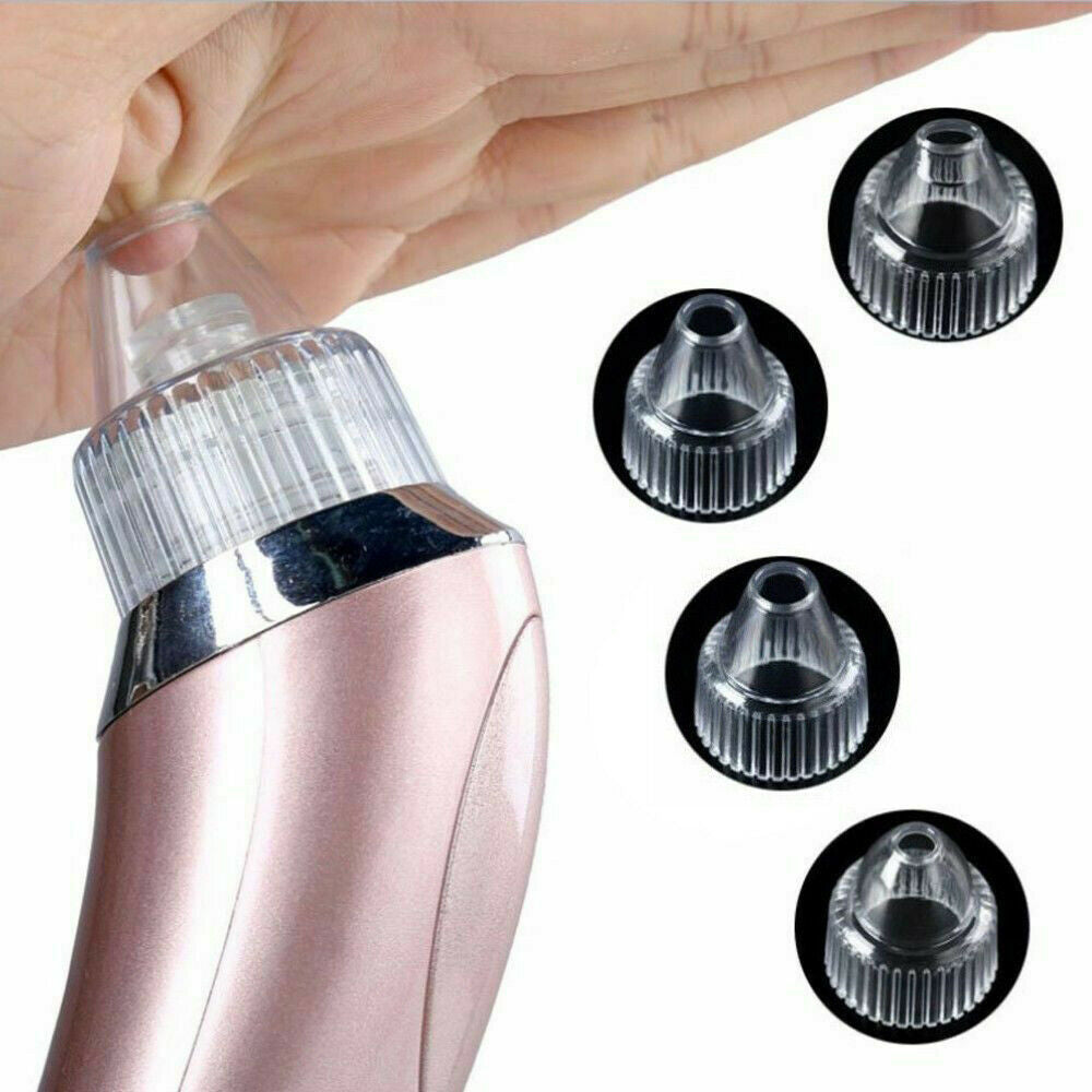 Aspiradora eléctrica LuxuryGlow para eliminar puntos negros (4 cabezales, USB)