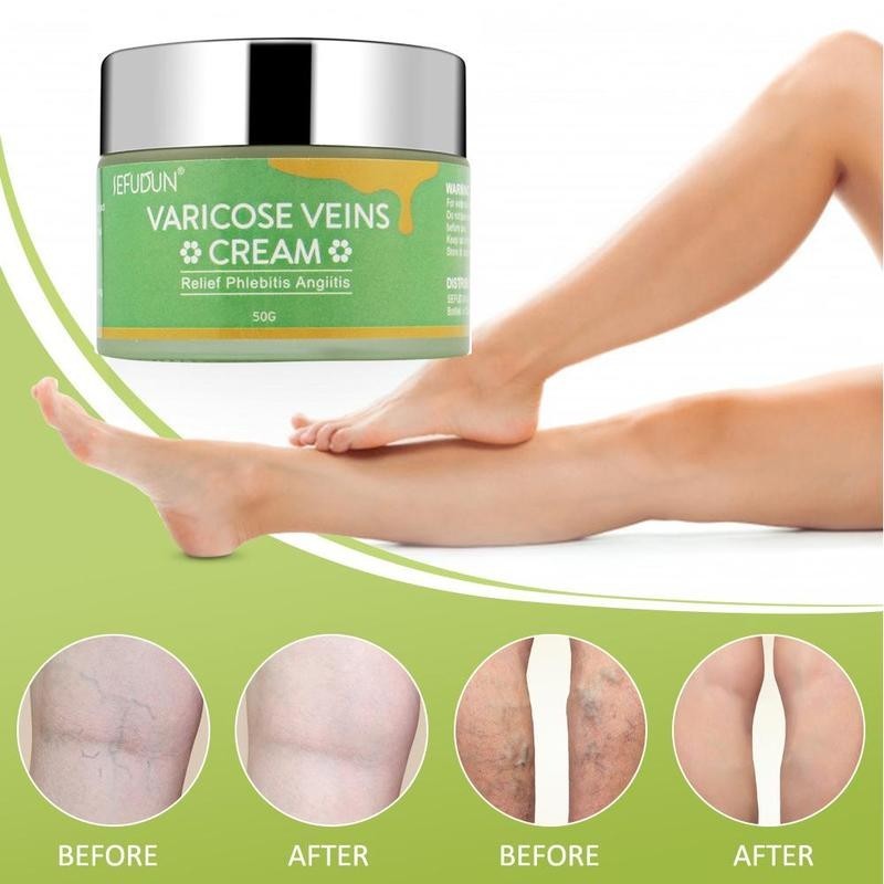 Crema para varices SEFUDUN: reduce hematomas, hinchazón y molestias venosas en las piernas (50 g)