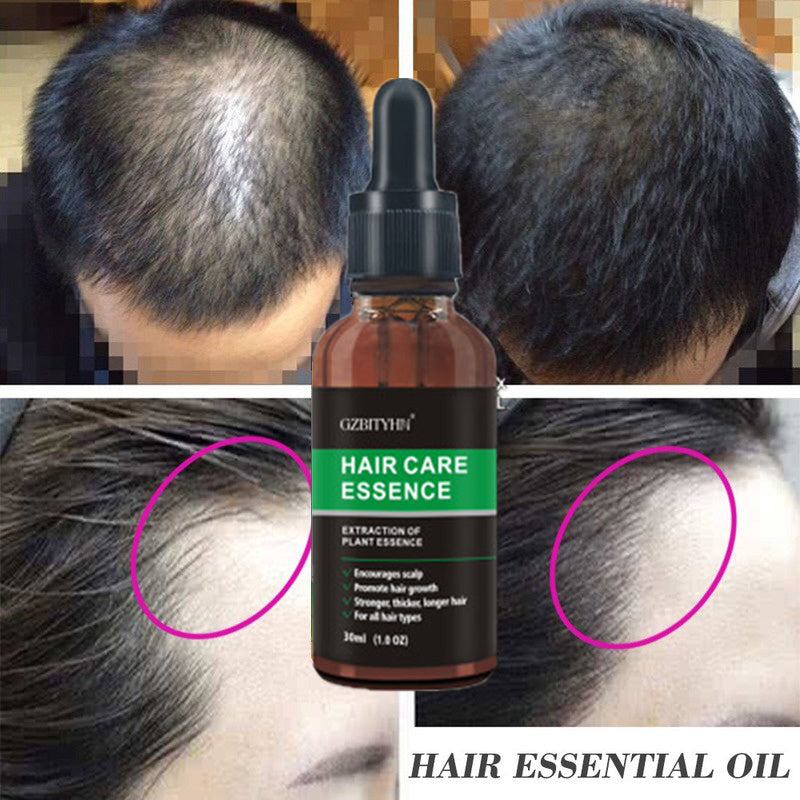 MEN’S HAIR GROWTH